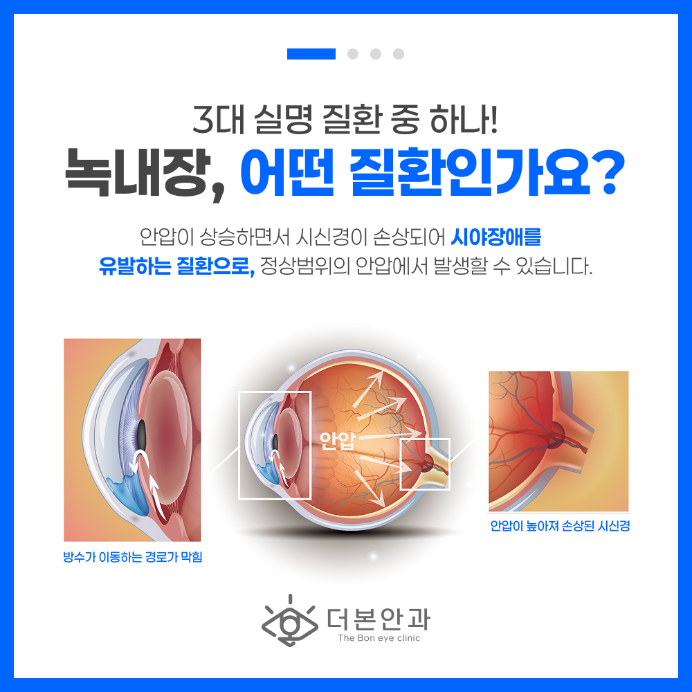 분당녹내장검사 시야검사 안내 이미지